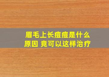 眉毛上长痘痘是什么原因 竟可以这样治疗